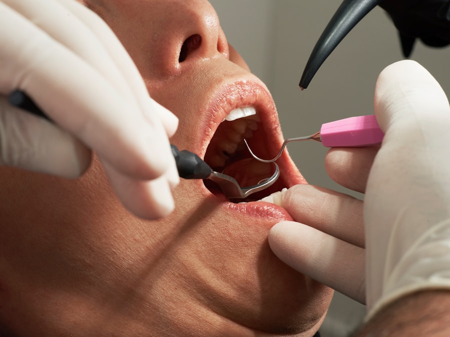 Urgent Dental Care in Boston: What You Need to Know dental care Boston