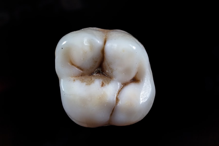 24 Hour Dentist Boston: Emergency Dental Care Available Around the Clock 24 hour dentist Boston